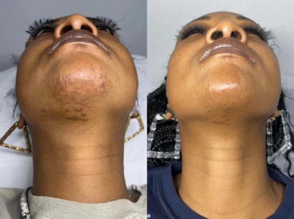 Kiara Mendoza testimonial