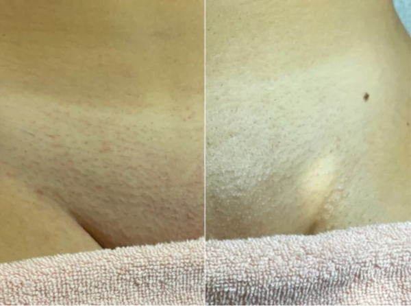 Amanda Pezoa testimonial