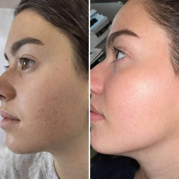 Florencia Ochagavía testimonial